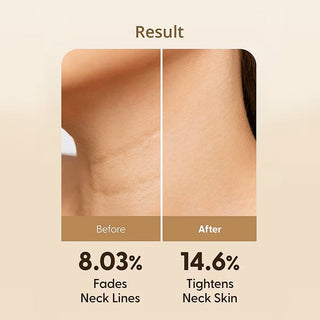 PEPTIDE VOLUME NECK CREAM- Crema Premium Dedicata Zonei Gatului Pentru Fermitate Cu Aplicator